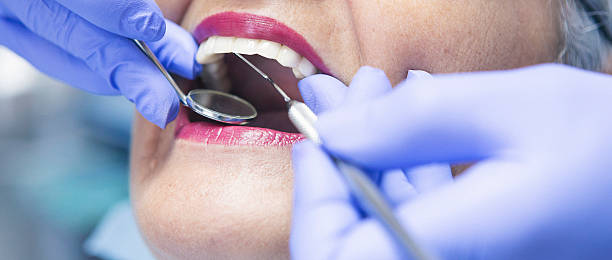 Best Mobile Emergency Dentist in Singac, NJ